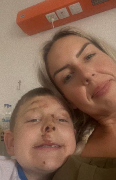 A mother and her son in a hospital bed after a motorbike accident.