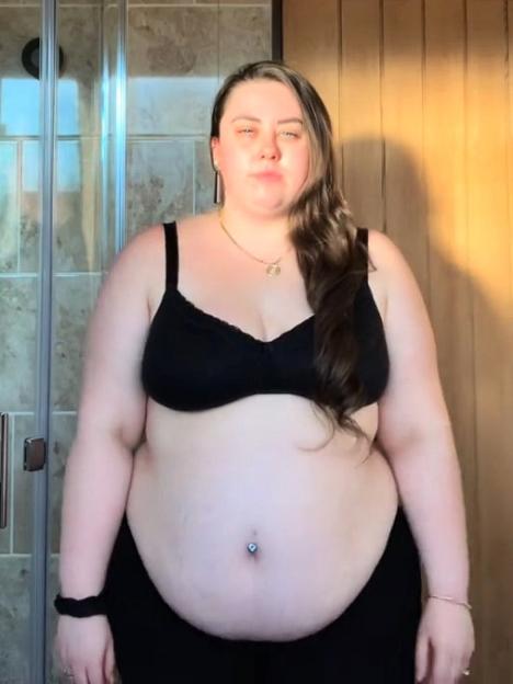 Woman before weight loss.
