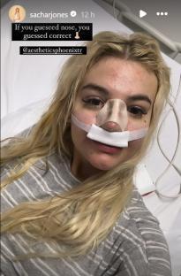 Woman in hospital bed after nose job.