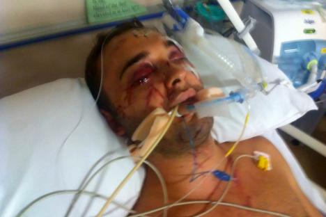 I can’t cuddle my kids after being left paralysed in 91mph head-on crash that killed my friend in the seat next to me