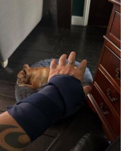 Person's arm in a sling reaching toward a dog.