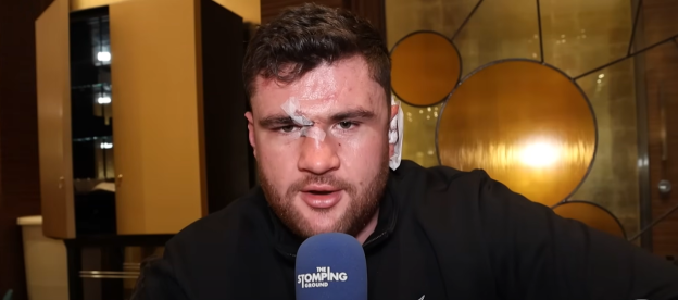 Man with facial injuries speaks into a microphone.