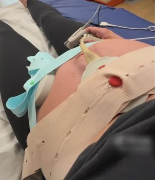 Pregnant woman in hospital undergoing fetal monitoring.