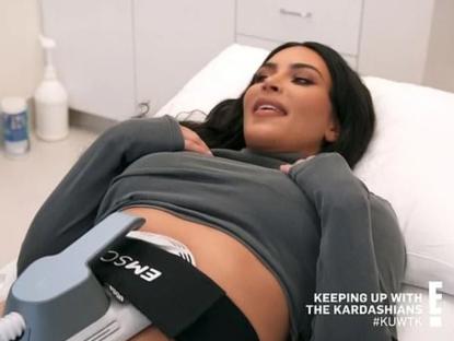 Kim Kardashian receiving Emsculpt treatment.