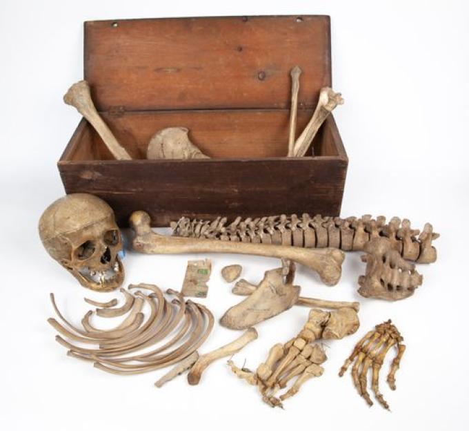 Human skull and assorted bones in a wooden box.