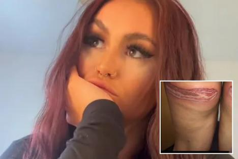 I was on Just Tattoo Of Us in 2019 & got the worst leg tattoos for having streaky fake tan, all I can do now is laugh
