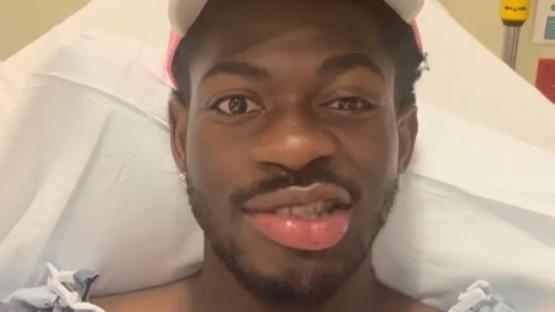 Lil Nas X reveals one side of his face is paralyzed