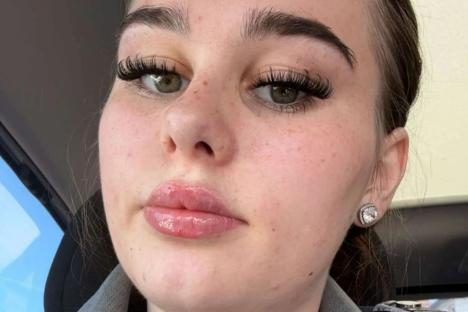 Mum shares horrifying photos after baby bottle ‘explosion peeled half her nipple off’ and left her fearing she’d die