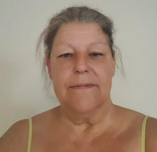Gina Evans, a woman injured in a dog attack.