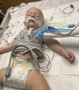 A toddler on life support in a hospital bed.