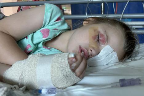Mum issues urgent warning to parents after her little girl, 4, was blinded while she turned her back to do the laundry