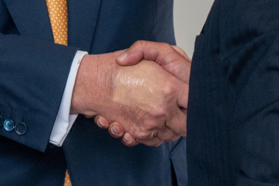 July 16, 2025, Washington, District of Columbia, USA: President DONALD TRUMP's hand shows signs of makeup after reports emerged that he possibly had bruised his hand the other day. (Credit Image: ¿ Andrew Leyden/ZUMA Press Wire) EDITORIAL USAGE ONLY!
