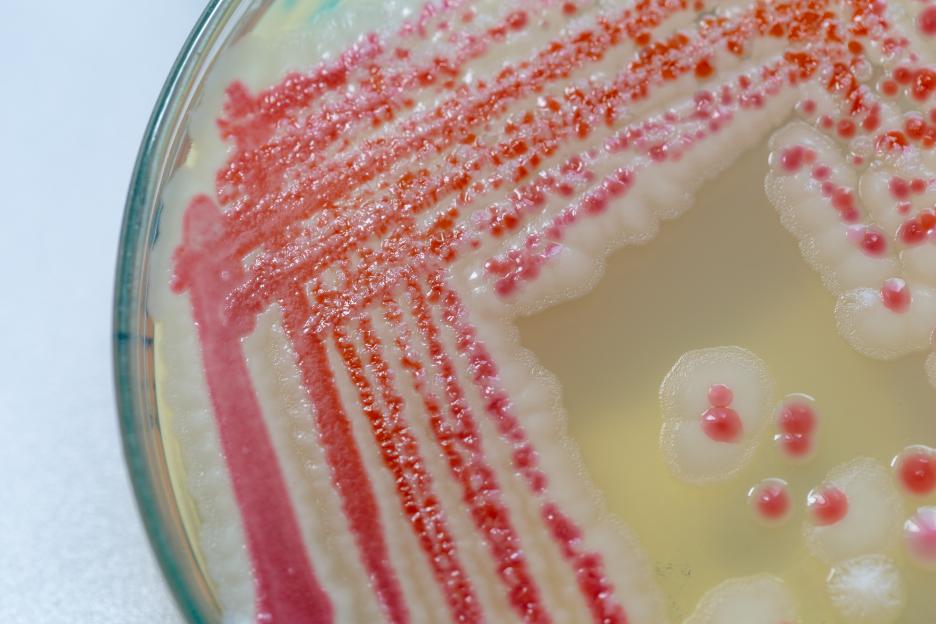 Serratia marcescens bacteria colonies on agar plate.