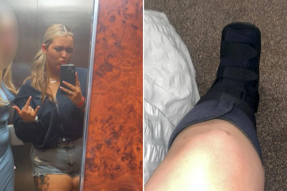 Woman warns against Crocs in waterparks blaming a pair for leaving her hospitalised with cracked ribs on family day out
