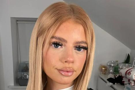 I was obsessed with looking fake with huge lashes & ‘criminal’ filler – my glow-down & natural beauty has people stunned