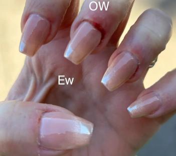 Before and after photos of a manicure; the before photo shows clear nails, and the after photo shows damaged, peeling nails.