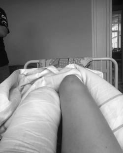 Black and white photo of a woman's legs in a hospital bed, one leg bandaged.