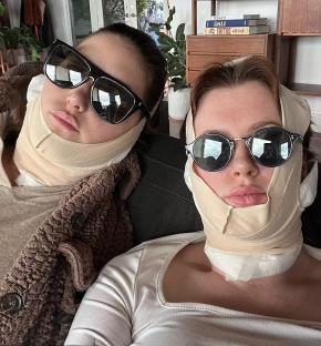 Two women wearing sunglasses and post-surgical face bandages.