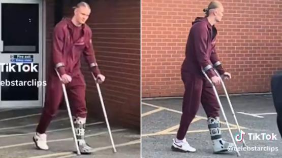 Erling Haaland leaves Bournemouth in protective boot and on crutches in major scare for Man City after FA Cup injury