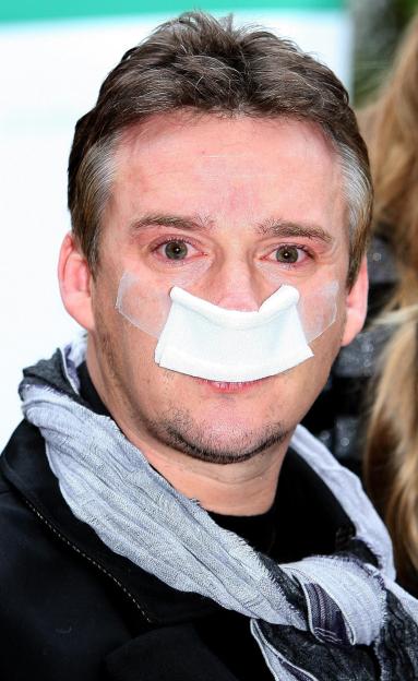 Russell Watson after brain tumour surgery.