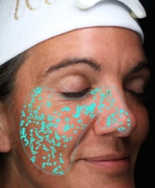 Skin analysis showing spots, wrinkles, texture, pores, UV spots, brown spots, red areas, and porphyrins; actual age 46, TruSkin Age 53.