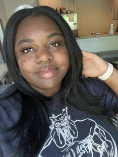 Close-up selfie of a woman showing her weight loss after using Ozempic.