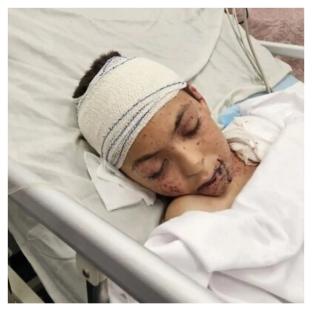 Child survivor of Israeli airstrike in Gaza flown to Italy for urgent medical treatment