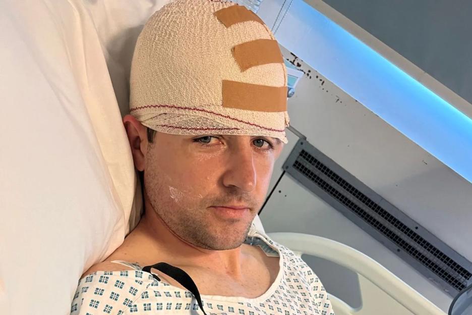 My brain FLIPPED in my skull as my head smashed against the road when a drunk driver ploughed into me then ran off