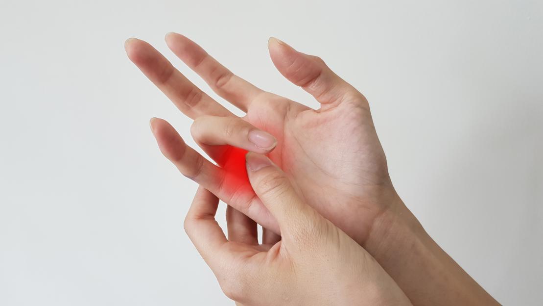 Hand with trigger finger.