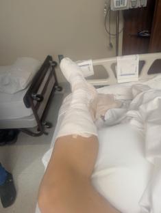 Bandaged foot in a hospital bed.