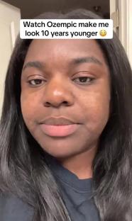 Close-up video of a woman's face, showing the effects of Ozempic on her skin.