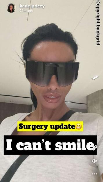 IMAGES TAKEN FROM SNAPCHAT BACKGRID FEE: £50 , Katie Price struggles to smile after surgery, , https://www.snapchat.com/@katie-pricey
