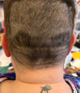 Back view of a person's head with a poorly executed hair tattoo.