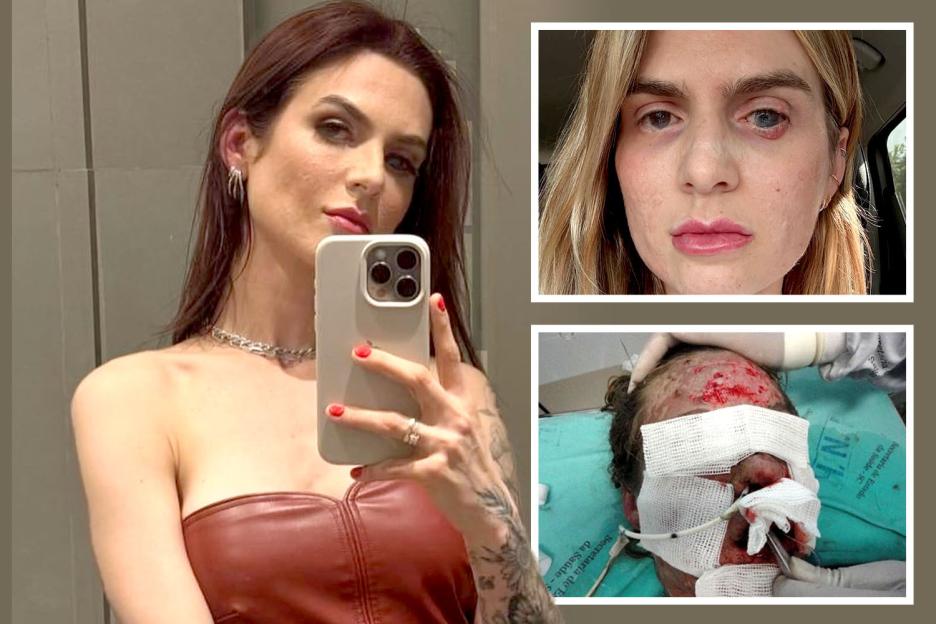 Collage of a woman before and after a serious facial injury.