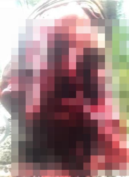 Graphic image of a severely injured face.
