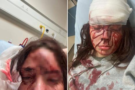 Young Scots mum, 20, covered in blood & left for dead after being battered in ‘pole attack’ horror