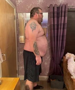 Profile view of an obese man with tattoos.