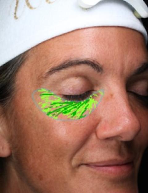 Skin analysis showing spots, wrinkles, texture, pores, UV spots, brown spots, red areas, and porphyrins; actual age 46, TruSkin Age 53.