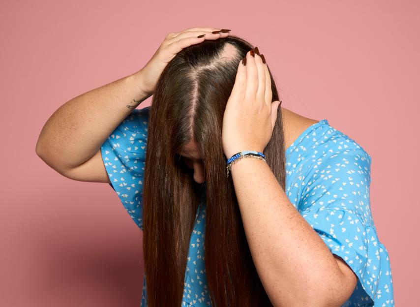 Charlotte Dodds revealing a bald patch on her head from pulling her hair.