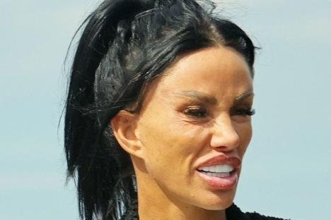 Katie Price’s £10k facelift looks painfully tight as she’s spotted walking her dog in Wales