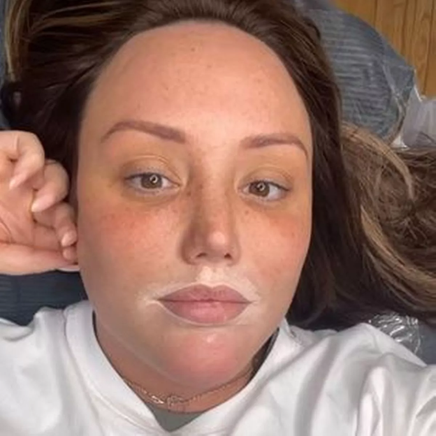 Charlotte Crosby with numbing cream on her lips for a lip blush tattoo.