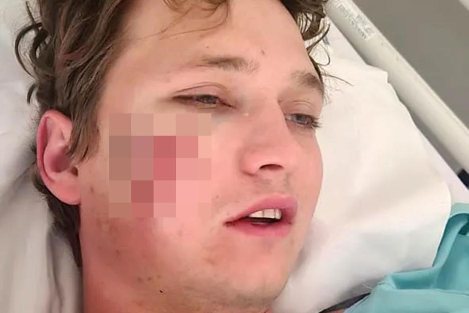 Stag do bloke, 27, mauled by two ferocious HYENAS after being dragged out of tent where he was sleeping off booze