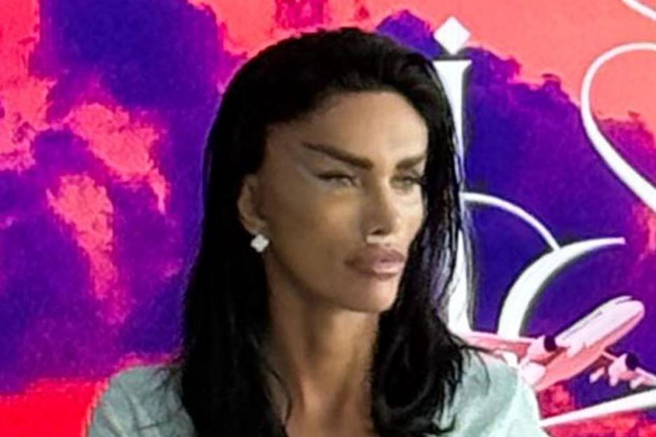 Katie Price shows off painfully tight looking face after new ‘fox eye’ facelift in Turkey