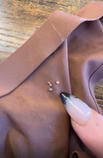 Close-up of a woman's finger pointing at small, jelly-like lumps on a brown fabric.