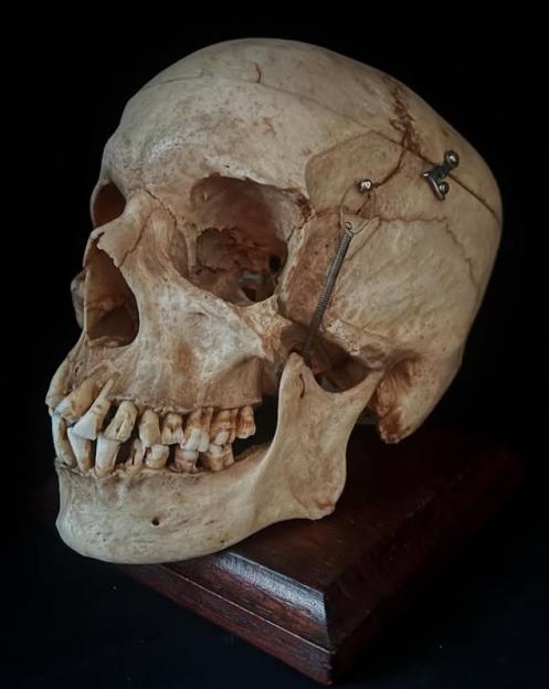 Human skull on a wooden stand.