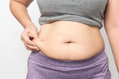 Woman pinching excess belly fat.