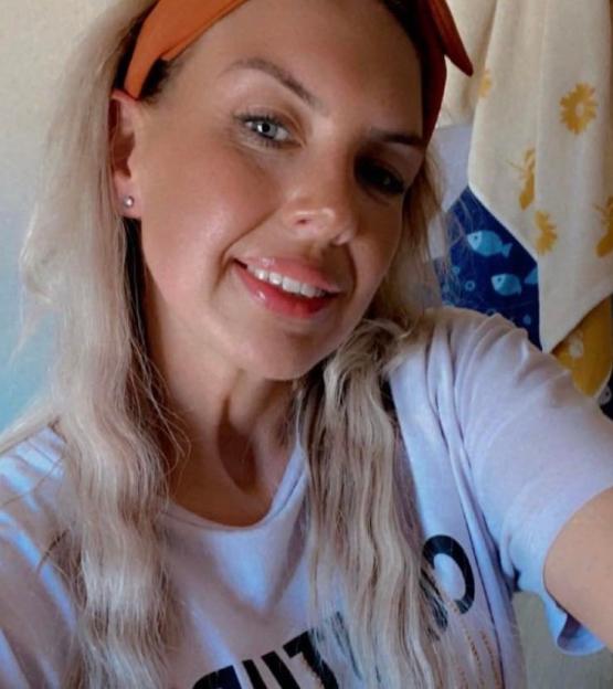 Chloe Mackie, a woman who sustained injuries in a motorbike accident.