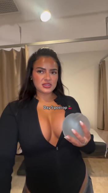 Love Island's Andrada Flaunts Her New Look Just Five Days Post-Surgery!