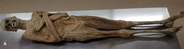 Mummified body lying on a metal surface.