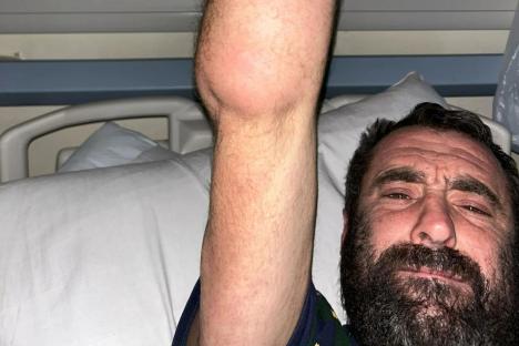My limbs nearly exploded and I’ve been left with arthritis after a spider in the UK bit me in my sleep